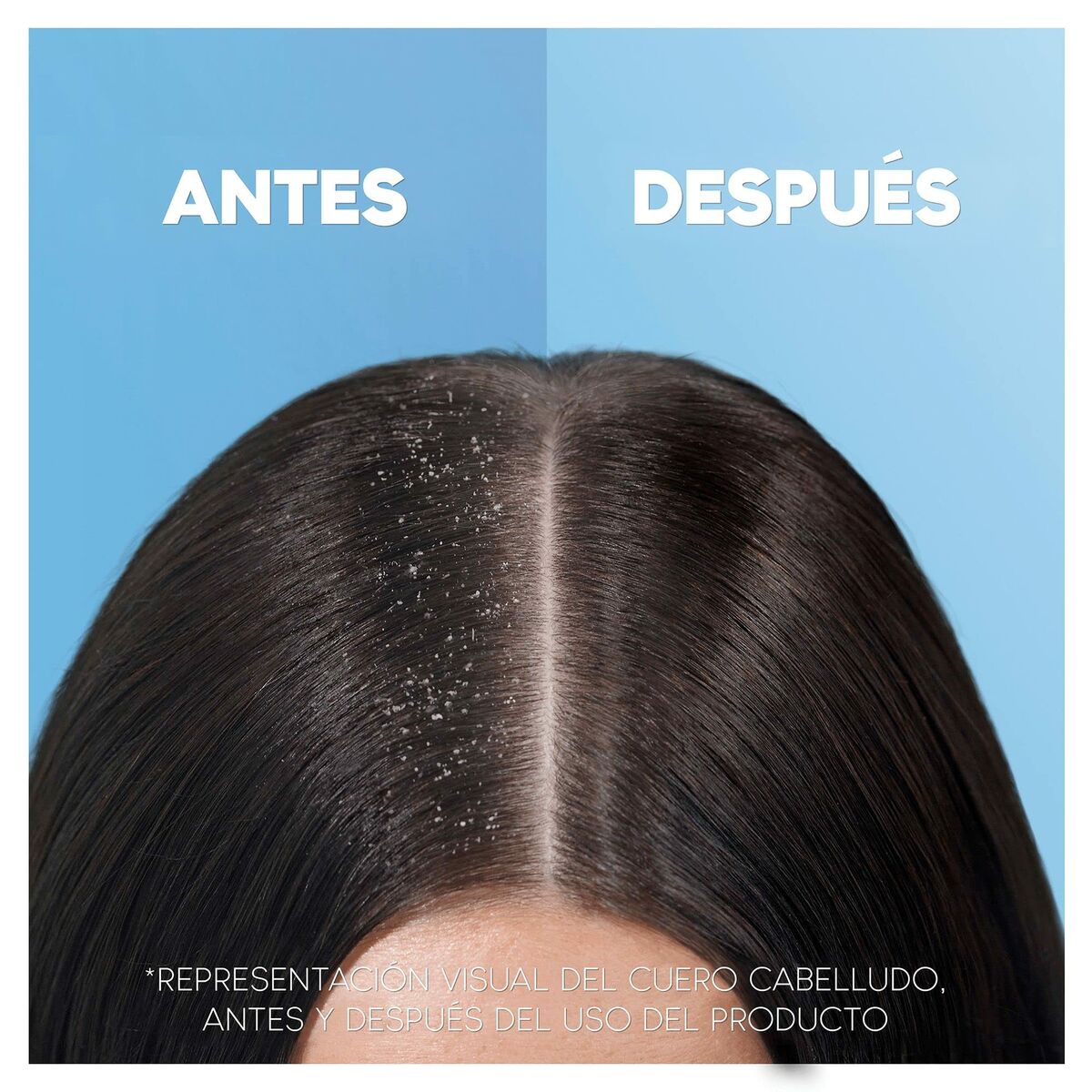 Shampoo Head & Shoulders H&S Clásico 1 L-3