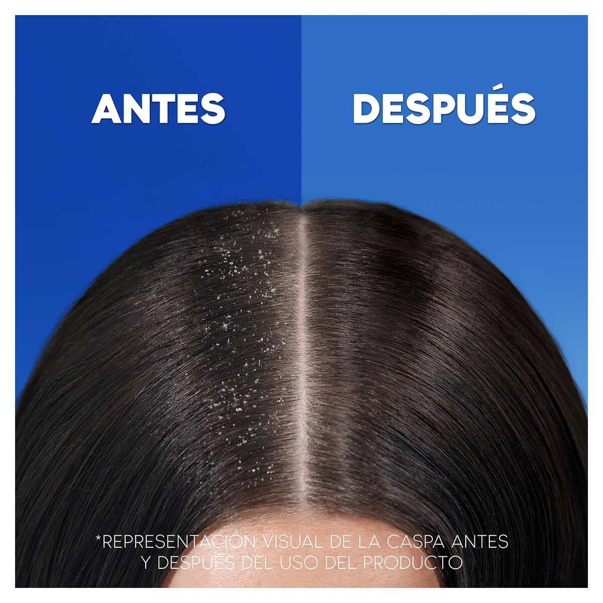 Shampoo Head & Shoulders S Anticaída 1 L-6