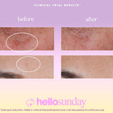 Gesichtsserum Hello Sunday The One That Makes You Glow Dark Spot SPF 40 (30 ml)-1
