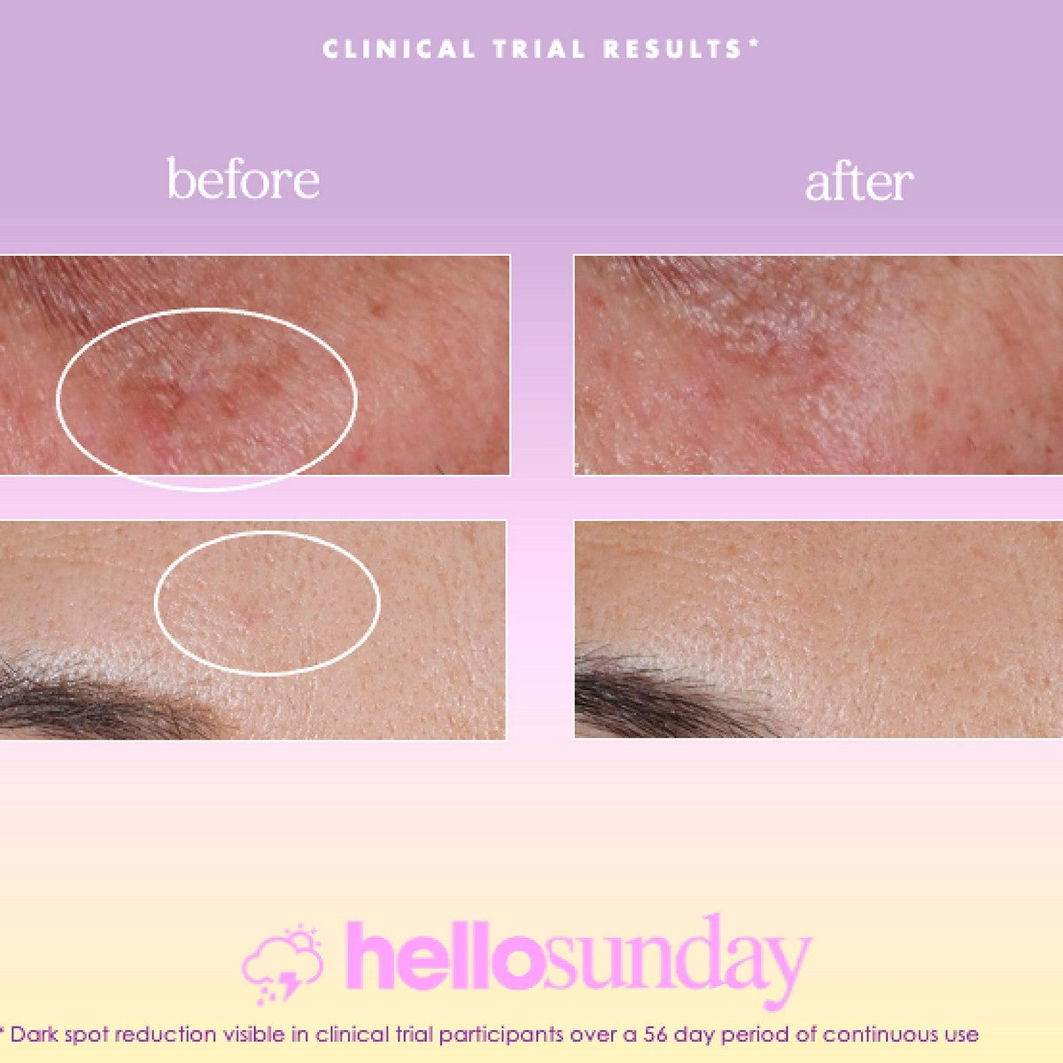 Gesichtsserum Hello Sunday The One That Makes You Glow Dark Spot SPF 40 (30 ml)-1