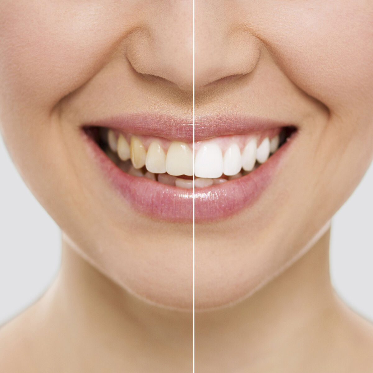 Teeth Whitening Strips Wripes InnovaGoods-9