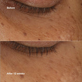 Aufhellendes Serum Clinique ALL ABOUT EYES 10 ml-4